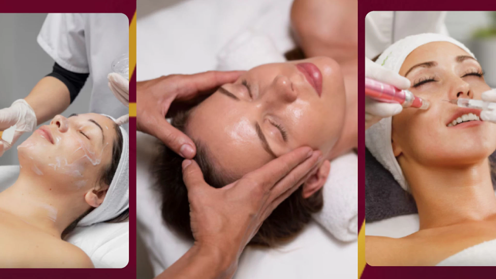 Microagulhamento Facial